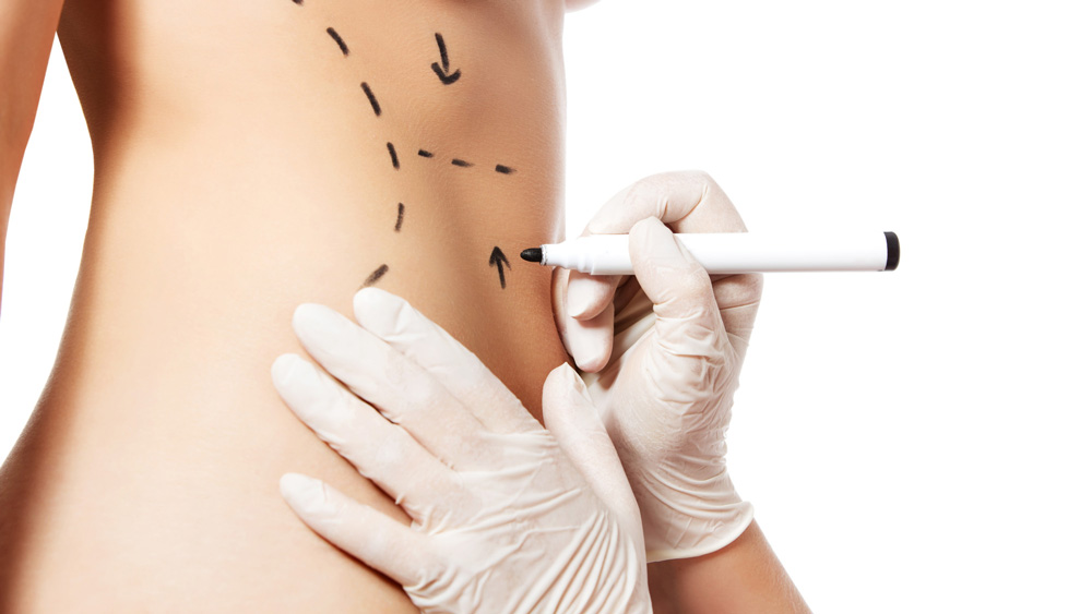 Read more about the article 5 Amazing Benefits of Plastic Surgery You’ll Love