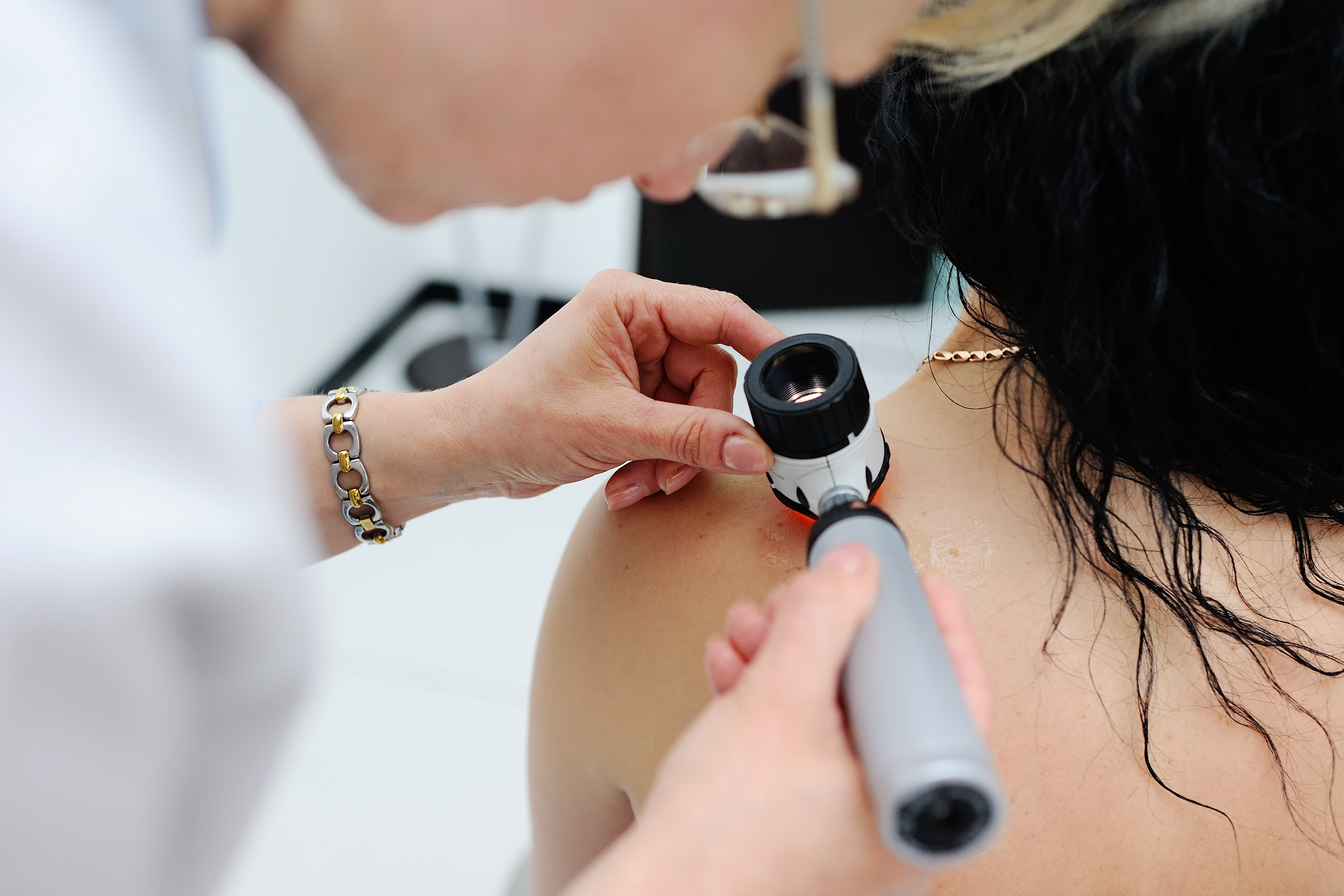 Read more about the article Top 5 Reasons To Get Your Skin Checked