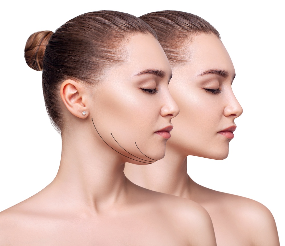 Read more about the article What is the Best Procedure to Lose Double Chin?