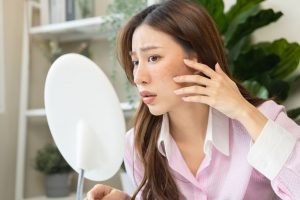 Read more about the article How to Get Rid of Sun Spots on Face – Skincare Tips & Advice