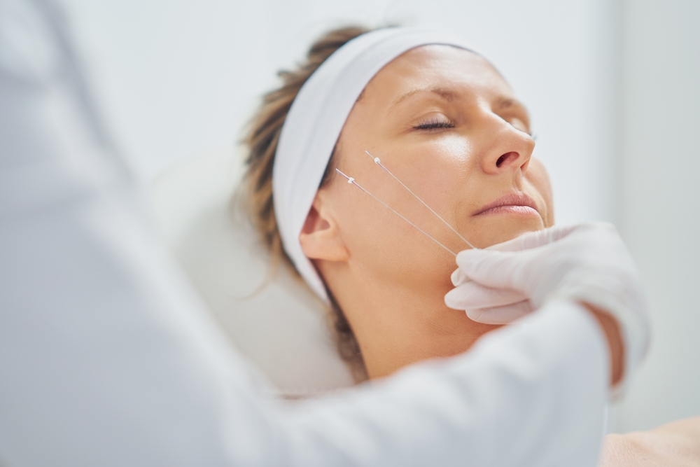 Read more about the article Disadvantages of Thread Lift: Risks, Limits & Results Explained