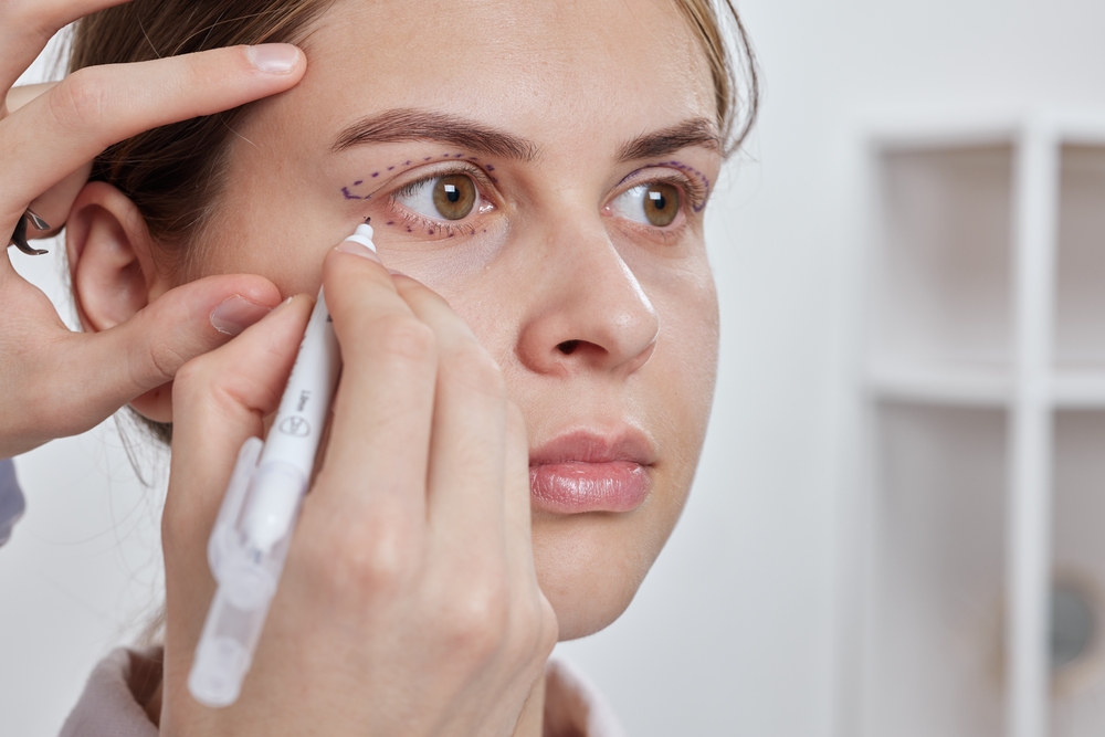 Read more about the article Upper vs Lower Blepharoplasty: What’s the Difference?
